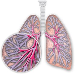 Illustration of the lungs and pulmonary blood vessels