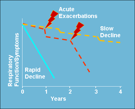 Diagram illustrating different patterns of IPF progression over time